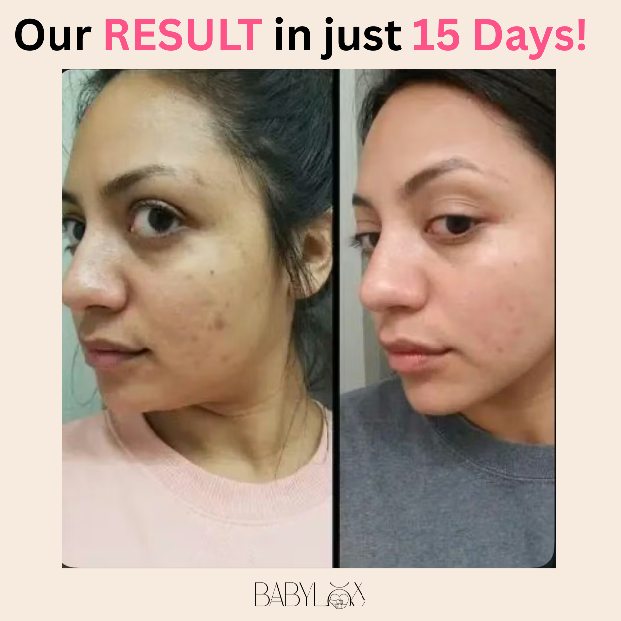 Glowing Goddess Serum | Niacinamide + Hyaluronic Acid